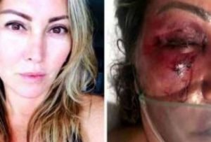 Justiça do RJ decide que homem que agrediu mulher durante o sono é inimputável