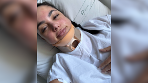 Jovem linha cerol sc 1 5.png