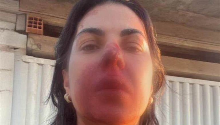 Oficiala de Justiça é agredida com cabeçadas e socos por PM enquanto cumpria mandado no Dia da Mulher