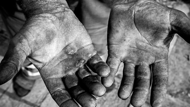 Juiz reconhece trabalho análogo à escravidão em local para tratar dependentes químicos e condena instituição a indenizar pacientes