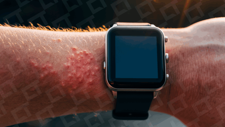 5 maneiras de limpar o smartwatch do jeito certo e evitar alergias