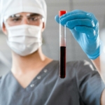 ANS: planos de saúde deverão cobrir exame de RT-PCR quantitativo para leucemia